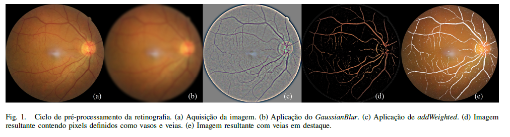 Figura principal do artigo: Filtragem como pré-processamento de CGAN na detecção de glaucoma